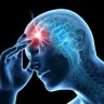 MigraineAttack